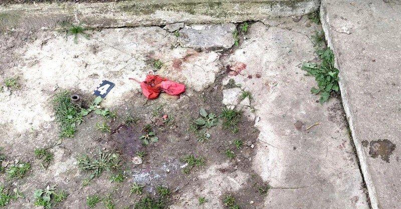 В сусідній з Тернопільщиною області домашня вівчарка загризла немовля