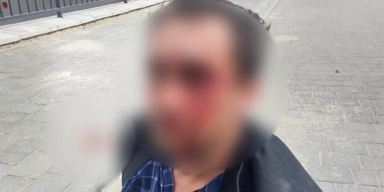 В Тернополі чоловік трощив припарковані автомобілі