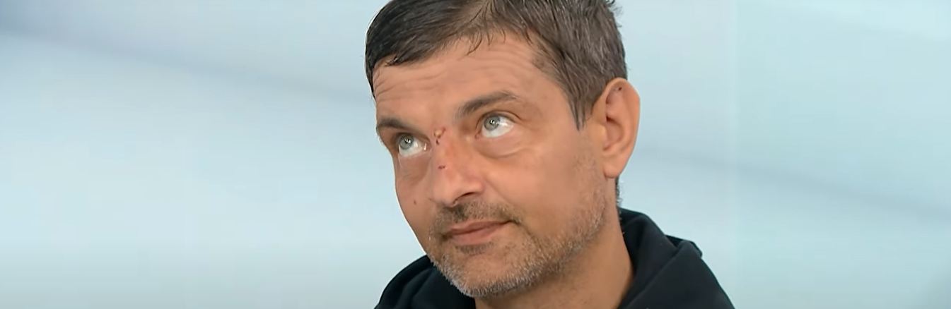 Оборонець Маріуполя тернополянин Михайло Діанов розповів, у якій країні проходитиме лікування