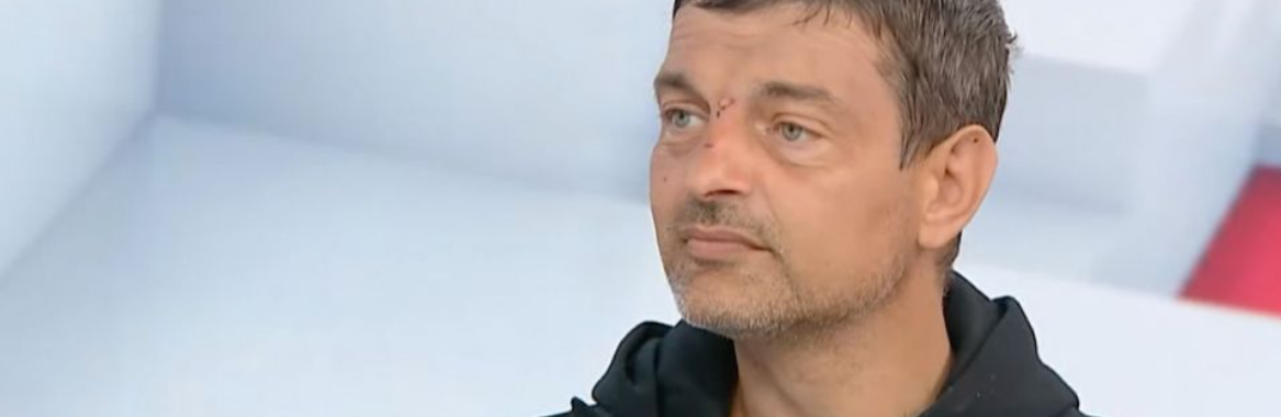 Звільнений з полону Михайло Діанов з Тернополя розповів, куди спрямує зібрані 23 мільйони гривень на його лікування