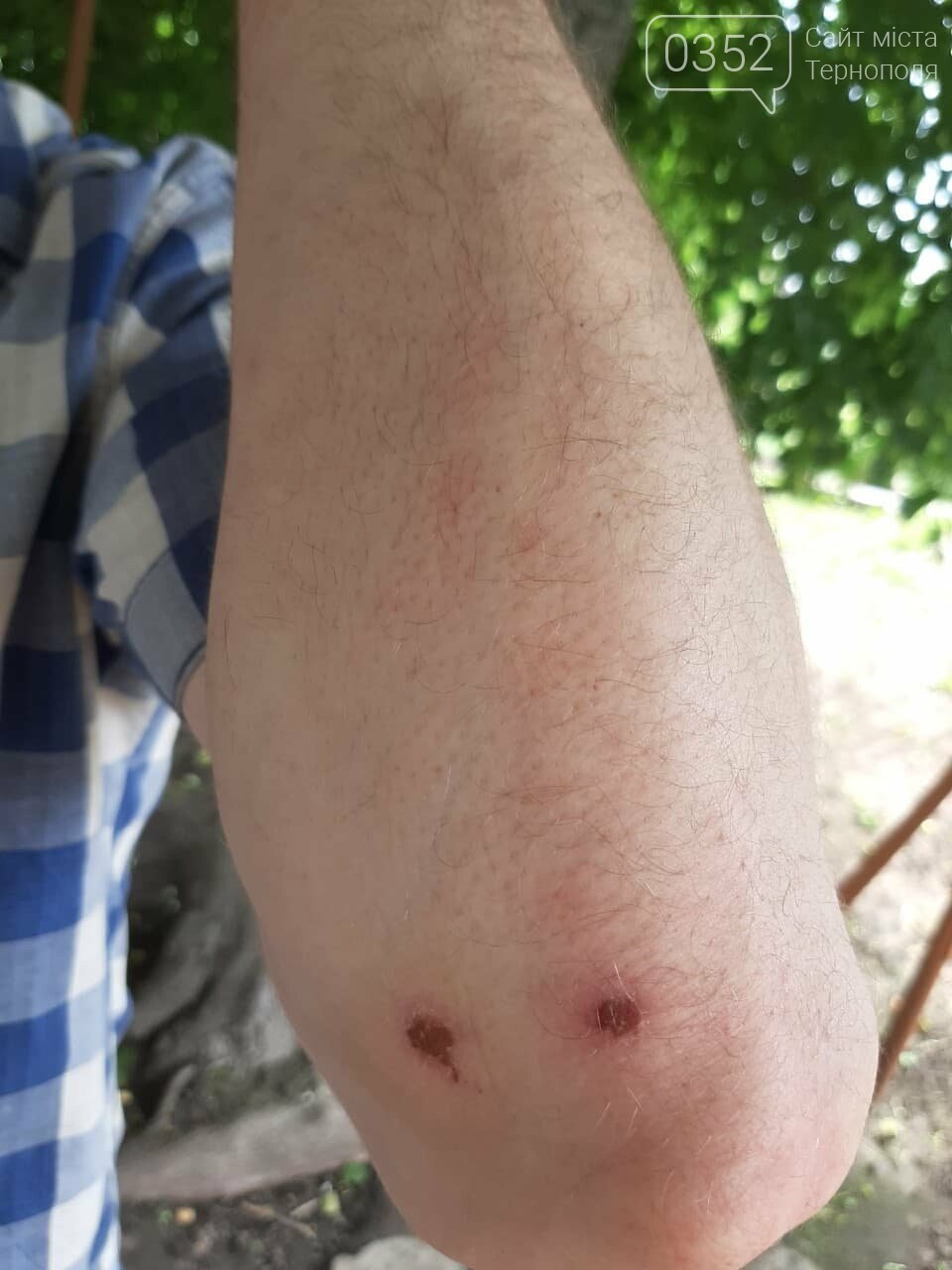 На Тернопільщині сина працівника правоохоронних органів під..., фото-6 На Тернопільщині сина працівника правоохоронних органів підозрюють у вчинені крадіжки та звинувачують у побитті селянина (ФОТО), фото-6