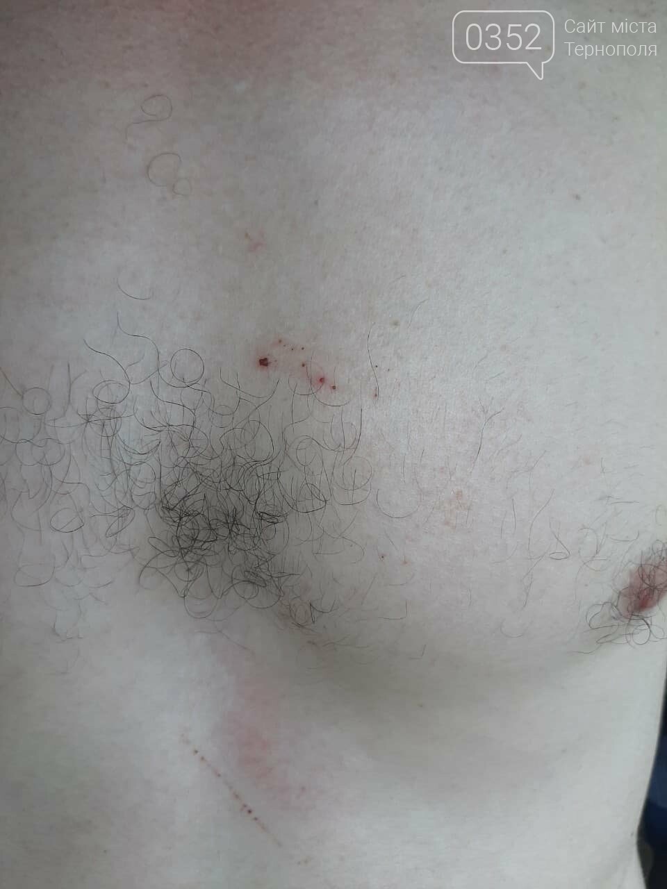 На Тернопільщині сина працівника правоохоронних органів під..., фото-5 На Тернопільщині сина працівника правоохоронних органів підозрюють у вчинені крадіжки та звинувачують у побитті селянина (ФОТО), фото-5