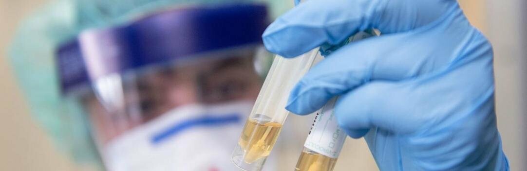 В Україні зафіксовано вже 113 випадків COVID-19