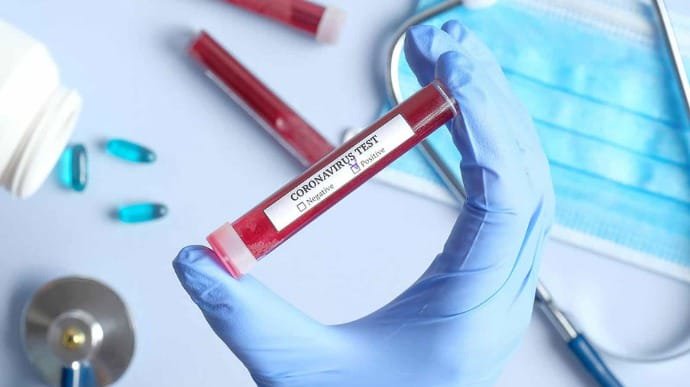 За минулу добу ще в 385 жителів області виявили коронавірус, семеро людей померли