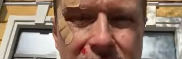 Запшикав і вдарив: у центрі Києва побили відомого журналіста